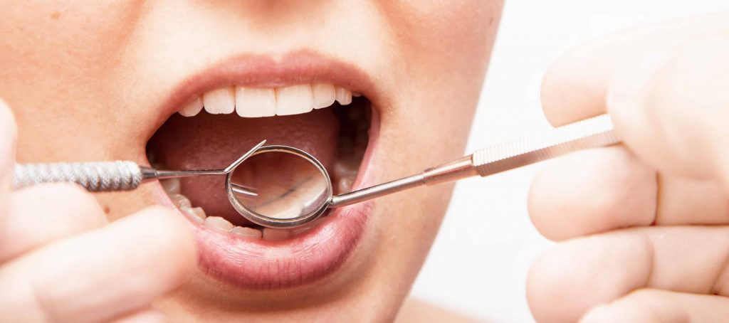 Tratamiento periodoncia en Málaga